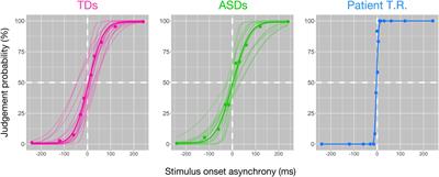 Neural Basis of Extremely High Temporal Sensitivity: Insights From a Patient With Autism